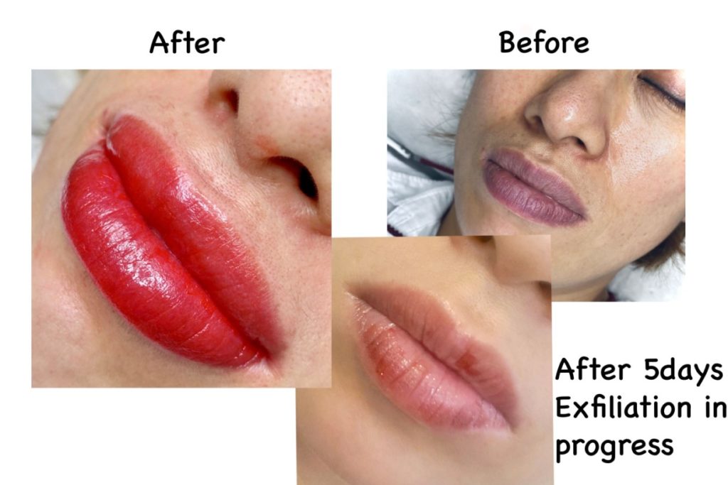 comparision of effect of pmu before and after procedure