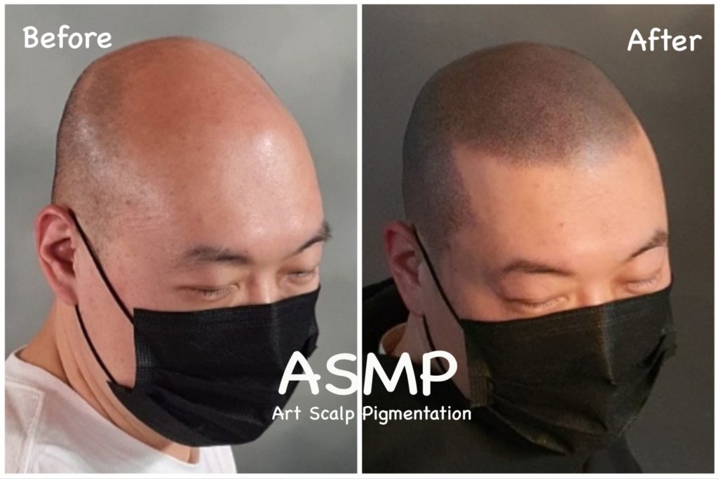 comparision of effect of pmu before and after procedure